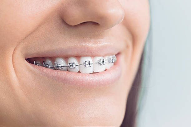 Best Full Mouth Reconstruction  in Bulverde, TX